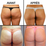 Appareil brûleur de graisses FatBurnerTM